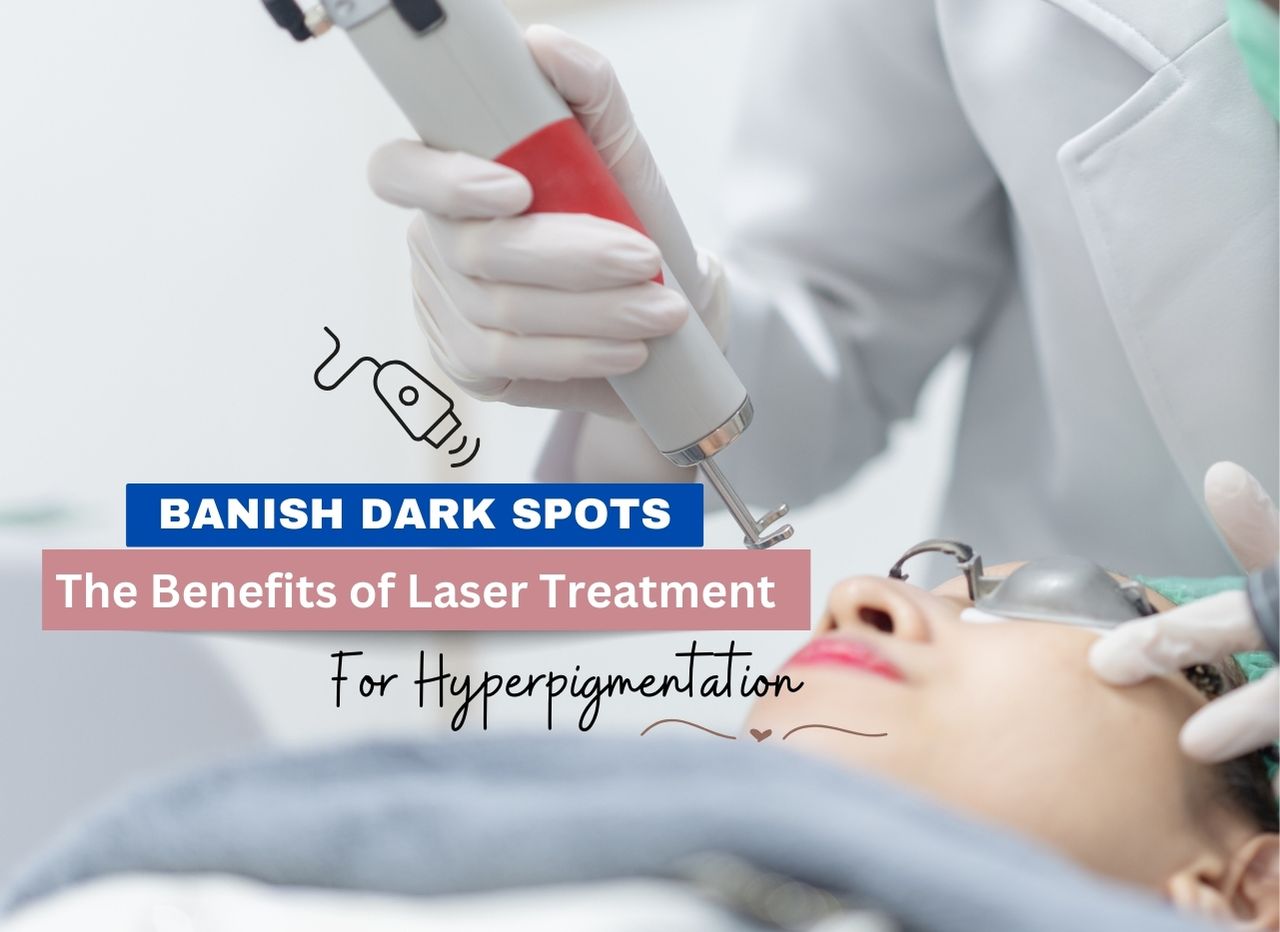  Banish Dark Spots: The Benefits of Laser Treatment for Hyperpigmentation