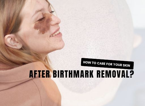 How to Care for Your Skin After Birthmark Removal?