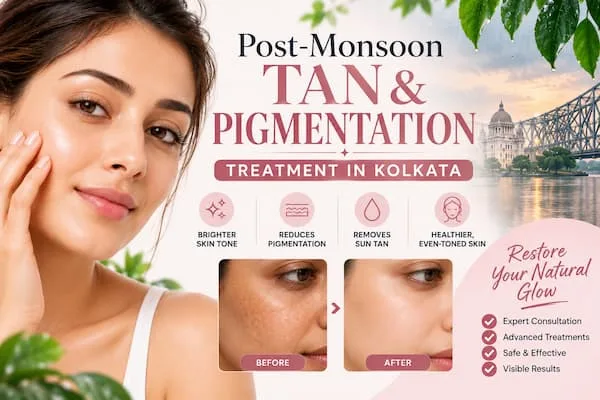 Post-Monsoon Tan and Pigmentation in Kolkata: Carbon Peel, Chemical Peel or Glutathione Before Diwali?