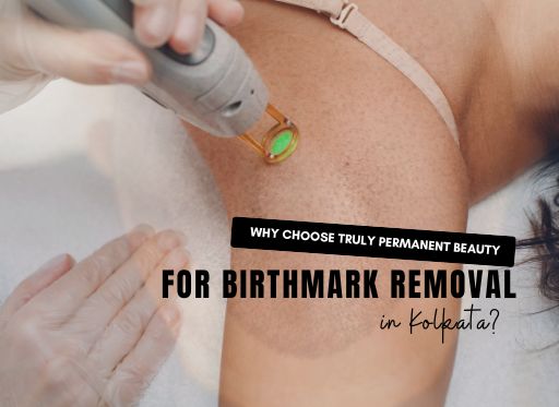 Why Choose Truly Permanent Beauty Clinic for Birthmark Removal in Kolkata?