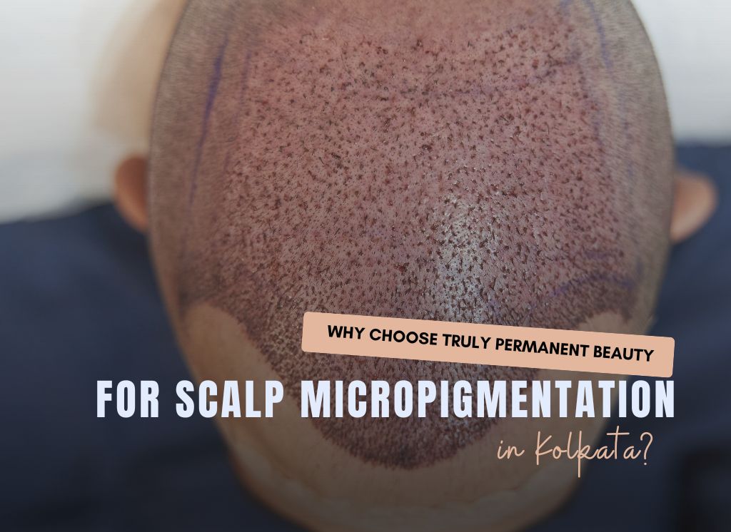  Why Choose Truly Permanent Beauty Clinic for Scalp Micropigmentation in Kolkata?