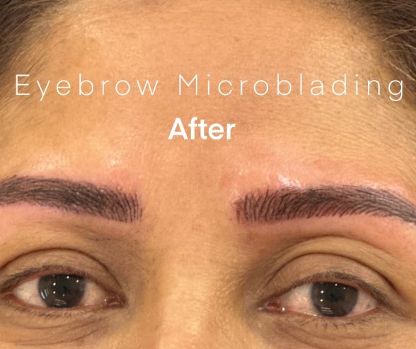 After eyebrow microblading