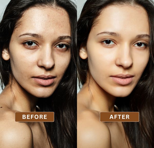 BB Glow before and after facial showing smoother and more even skin tone