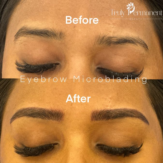 Before and after eyebrow microblading result showing fuller, well-defined natural brows created with hair stroke technique at a professional microblading clinic in Kolkata.