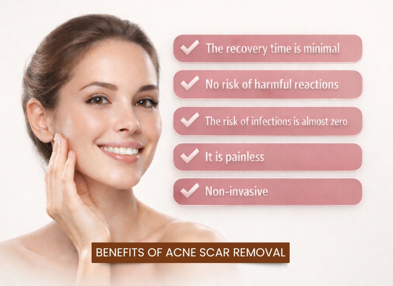 Benefits of acne scar removal treatment showing painless, non-invasive procedure with minimal recovery time