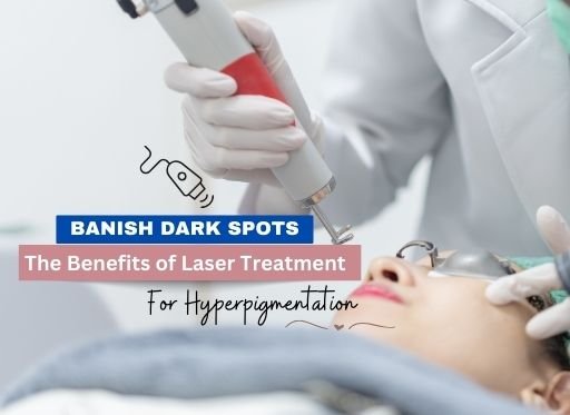 Banish Dark Spots: The Benefits of Laser Treatment for Hyperpigmentation