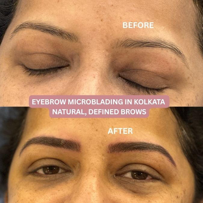 Eyebrow microblading in Kolkata before and after for natural, defined brows on Indian skin