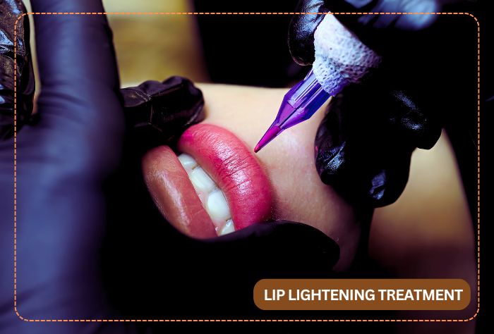 Lip Lightening Treatment in Kolkata