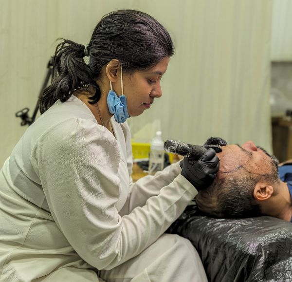 The scalp Micropigmentation in Kolkata done by PMU artist Shreya who did the permanent makeup fir removing baldness.