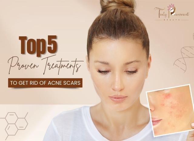 Here are the Top 5 Proven Treatments to get rid of acne scars that you can get at Truly Permanent Beauty.